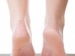 10 Tanda di Kaki yang Bisa Menjadi Pertanda Penyakit Bahaya, Mulai Sekarang Coba Periksa