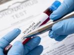 Menjadi Syarat Baru, Ini 4 Hal yang Perlu Diketahui Soal Rapid Test Antigen