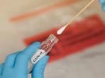 Ramai Rapid Test Antigen Covid-19, Berikut Daftar Kisaran Harganya di Bandara hingga Rumah Sakit