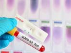 Wajib Tahu, Ini Kelebihan dan Kekurangan Rapid Test Antigen untuk Cek COVID-19
