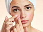 Gilrs, Ini 3 Rekomendasi Pelembap Lokal untuk Cerahkan Kulit dan Hilangkan Jerawat