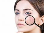 Jangan Khawatir, Begini Tips Alami Hilangkan Bopeng di Wajah dengan Garam