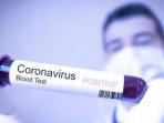 Kaum Pria Lebih Rentan Terinfeksi Virus Corona Ketimbang Para Wanita, Ini Penjelasan Ahli