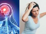 Sebelum Terlambat, Kenali 6 Gejala Awal Serangan Stroke pada Tubuh Anda