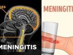 Bisa Membunuh Penderita Hanya Dalam Hitungan Jam, Deteksi Dini Gejala Meningitis dan Septicaemia
