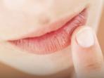 Ketahui Girls, Berikut 4 Hal yang Bisa Menyebabkan Bibir Kering