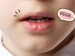 Mudah dan Simpel, Ini 6 Cara Mengatasi Bibir Kering Selama Puasa 