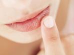 Meski Tampak Sepele, Ternyata Ini Bahaya Sering Mengelupas Kulit Bibir Kering