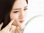Wajib Tahu Girls, Ternyata Ini 3 Jenis Skincare yang Bikin Kulit Jerawatan