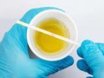 Kenali 11 Warna Urine dan Artinya Bagi Kesehatan Tubuh Kita