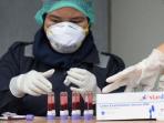 Ternyata Hanya 3 Kelompok Ini yang Butuh Rapid Test, Seperti Ini Peraturan Mengenai Tarifnya