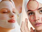 9 Cara Alami Hilangkan Flek Hitam di Wajah Tanpa Perlu Skincare Mahal