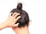 Bye-bye Gatal, Ini 12 Cara Efektif Untuk Membasmi Kutu Rambut dengan Bahan Alami