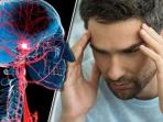 Kenali 10 Ragam Risiko Stroke yang Perlu Diwaspadai, Apa Saja?