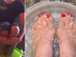 Rendam Kaki Anda ke Dalam Air Es Selama 15 Detik Tiap Malam, Rasakan Manfaat Menakjubkan Ini