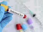 Tak Perlu ke Dokter, Ini Cara Mudah Cek Kadar Kolesterol Sendiri di Rumah
