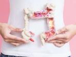 Perlu Diwaspadai, Ini 3 Gejala Kanker Usus Besar Pada Wanita yang Jarang Disadari