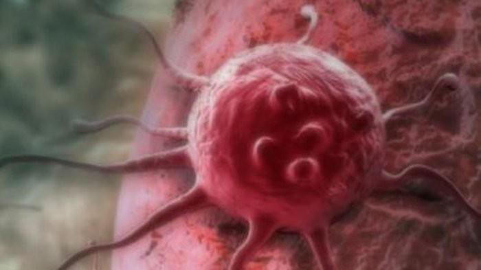 Selain Kanker Serviks, Ada 6 Jenis Kanker yang Bisa Menyerang Sistem Reproduksi Wanita