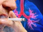 Selain Perokok, Ini 7 Orang yang Berisiko Terkena Penyakit Kanker Paru-paru