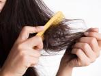 Ketahui Girls, Ternyata Ini Ciri Rambut Rontok karena Stres Menurut Ahli Dermatologi