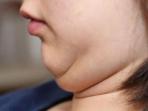 Simak 4 Tips Menyamarkan Hingga Menghilangkan Double Chin, Salah Satunya Rutin Minum Air Putih