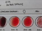 Benarkah Berdasarkan Urutan Golongan Darah, Ternyata Kita Bisa Tahu Potensi Umur Seseorang?