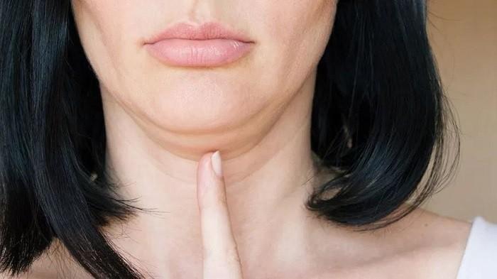 Jarang Diketahui, Ternyata Ini Berbagai Penyebab Double Chin Muncul