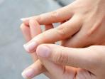 Kenali Faktor Penyebab Kuku Mudah Patah dan Rapuh dari Dermatolog