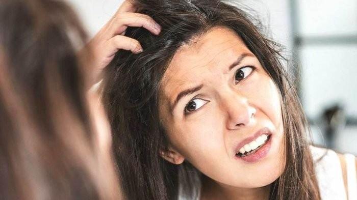 Jangan Khawatir Girls, Ini 5 Tips Atasi Rambut Lepek Karena Tidak ...