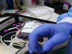 Tak Hanya Membantu Orang, Ini Manfaat yang Didapat dari Donor Darah