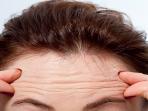 Tips Mudah Menghilangkan Kerutan pada Dahi Cuma Pakai Bahan Alami
