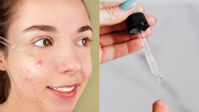 3 Manfaat Retinol pada Skincare dari Atasi Jerawat Hingga Cegah Penuaan Dini