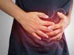 5 Gejala Gerd dan Cara Mengatasinya
