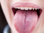 Jangan Panik, Begini Cara Mengatasi Lidah Kebas Akibat Makan Makanan Panas 
