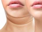 3 Cara untuk Hilangkan Double Chin dengan Mudah