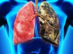 Buat yang Sudah Berhenti Merokok, Simak 3 Cara Bersihkan Paru-paru