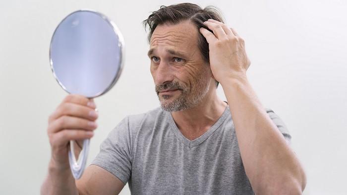 Penyebab rambut rontok pada pria | Foto Freepik