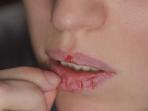 Simak 5 Cara Mengatasi Bibir Mengelupas dengan Mudah 