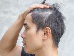Simak Yuk, Cara Menghilangkan Uban Secara Ampuh dengan Bahan Alami