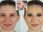 3 Kesalahan saat Pakai Make Up yang Menyebabkan Jerawat