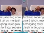 Michael Bocah dengan Kadar Gula Darah Tertinggi di Dunia, Kenali Yuk Gejala dan Penanganan Diabetes pada Anak