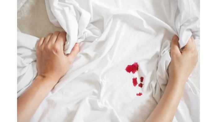 Ilustrasi Darah Menstruasi di Seprai yang Mengering. (The Sepruce)