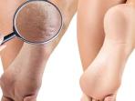 7 Cara Ampuh Mengatasi Kaki Pecah-pecah dengan Bahan Alami, Jadi Mulus Kembali