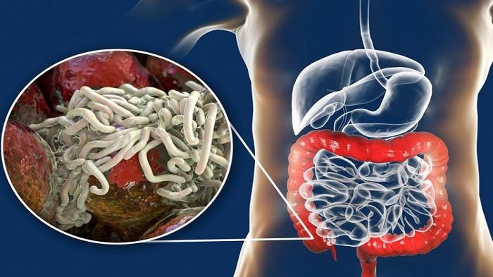 Ilustrasi parasit cacing (kompas.com)