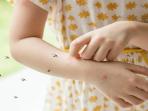 5 Rekomendasi Lotion Anti Nyamuk yang Aman untuk Anak-anak dengan Harga Terjangkau