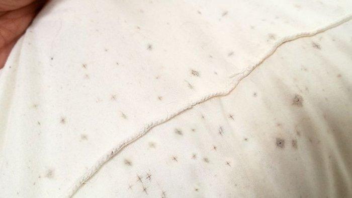 4 Cara Menghilangkan Jamur di Baju Putih dengan Benar