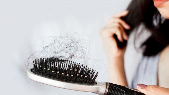 Kerontokan rambut | Tribunnews.com