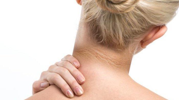 Leher hitam | Tribunnews.com